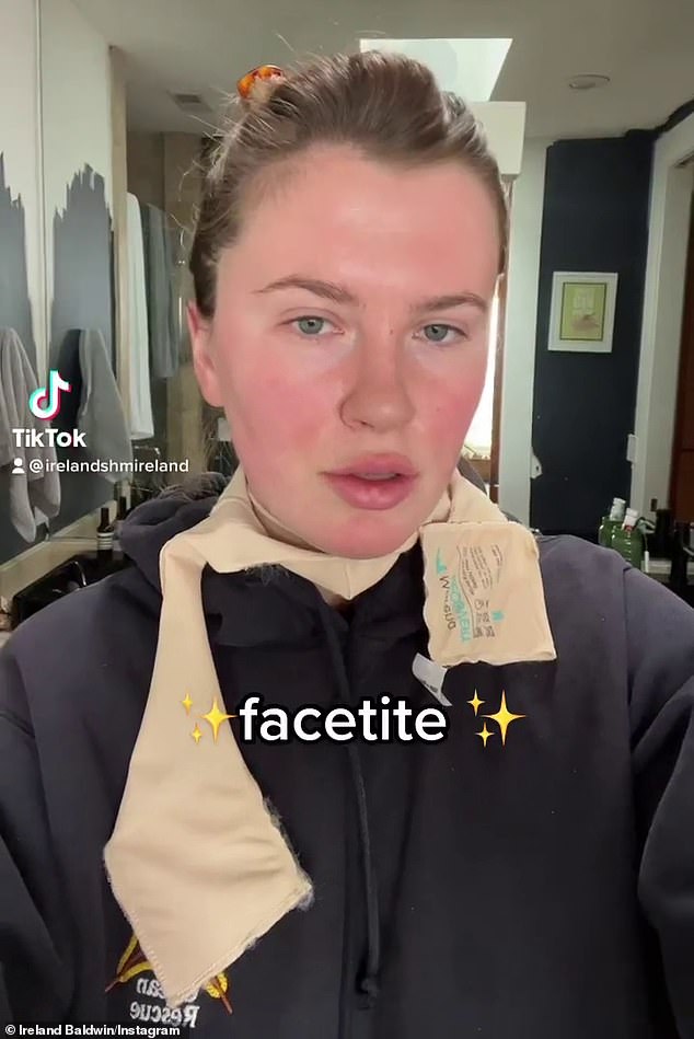 Eerlijk: Ierland Baldwin vertelt waarom ze deze maand FaceTite ondergaat, een minimaal invasieve cosmetische ingreep vergelijkbaar met een chirurgische facelift