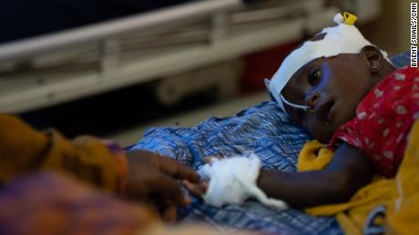 Fatima Abdullah reikt haar hand uit om haar 8 maanden oude dochter Abdi aan te raken, die in juli in Somalië met ernstige ondervoeding in het ziekenhuis werd opgenomen.